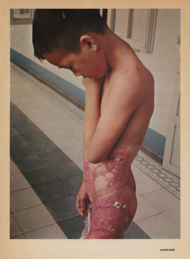 William F. Pepper y Benjamin Spock, "The Children of Vietnam” [Los niños de Vietnam], <em>Ramparts</em>, San Diego, vol. 5, n.º 7, enero, 1967, pp. 44-68